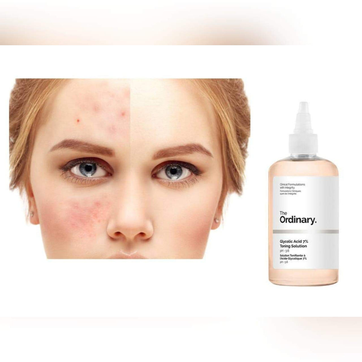 The Ordinary Glycolic Acid 7% Toning Solution